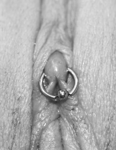 Genital piercings can take between 2 weeks and 6 months to heal completely,...