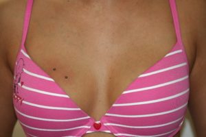 Brust piercing zwischen Does Nipple