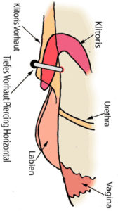 Vertikal piercing klitoris Klitorisvorhaut