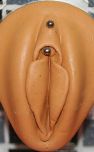 Vertikal klitorisvorhaut 