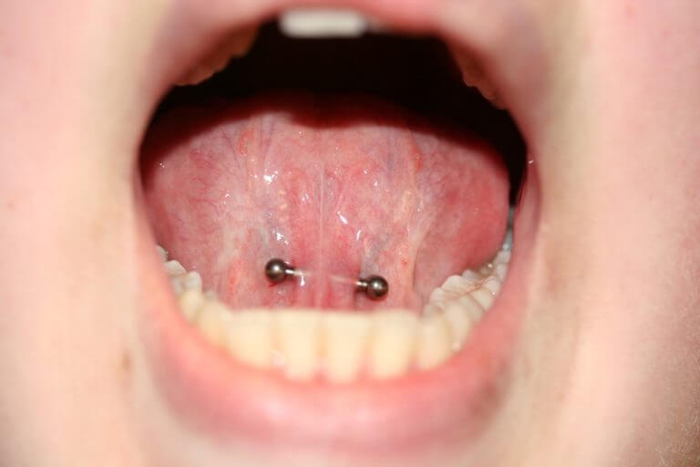 Zungenbändchen – Piercing Studio Wien