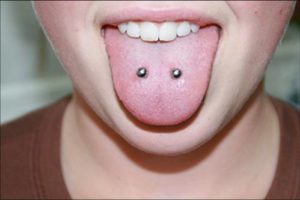 Schmerzen unter der zunge zungenpiercing Weißer Zungenbelag,
